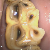 Tandonderzoek-met-camera Tandonderzoek-met-camera